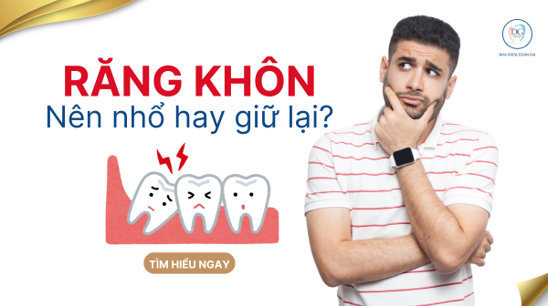 4. Răng khôn nên nhổ hay giữ lại