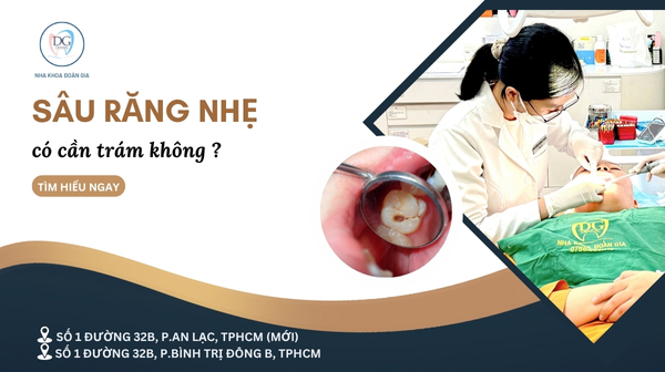4. SÂU RĂNG NHẸ CÓ CẦN TRÁM KHÔNG  ĐỪNG CHỦ QUAN VỚI LỖ SÂU NHỎ
