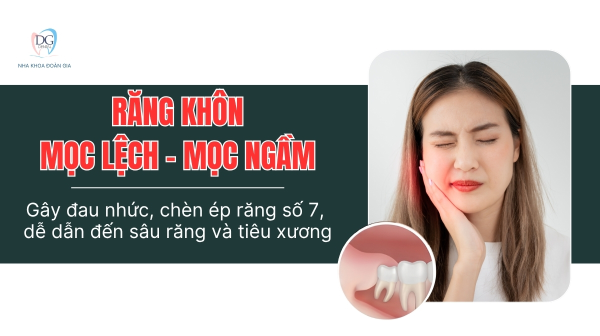 4 ĐỐI TƯỢNG NÊN NRK 1