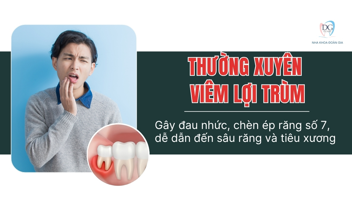 4 ĐỐI TƯỢNG NÊN NRK 2