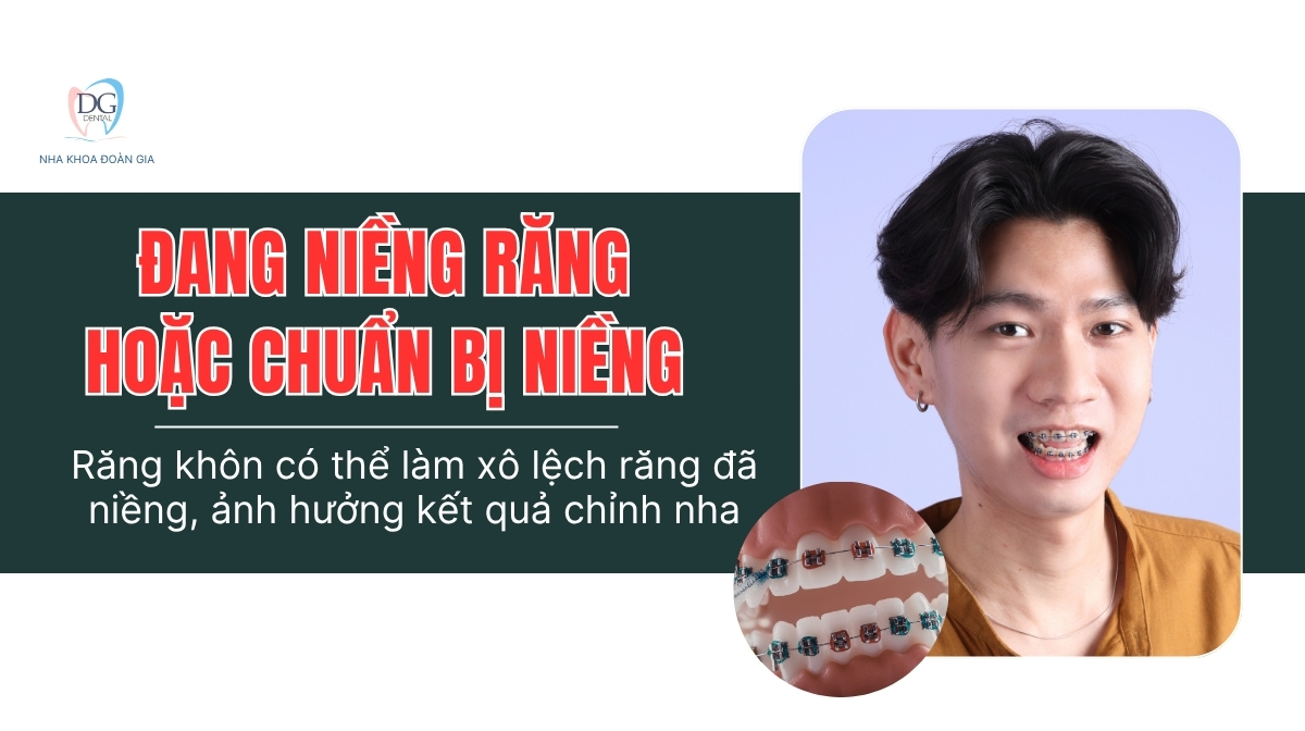 4 ĐỐI TƯỢNG NÊN NRK 3