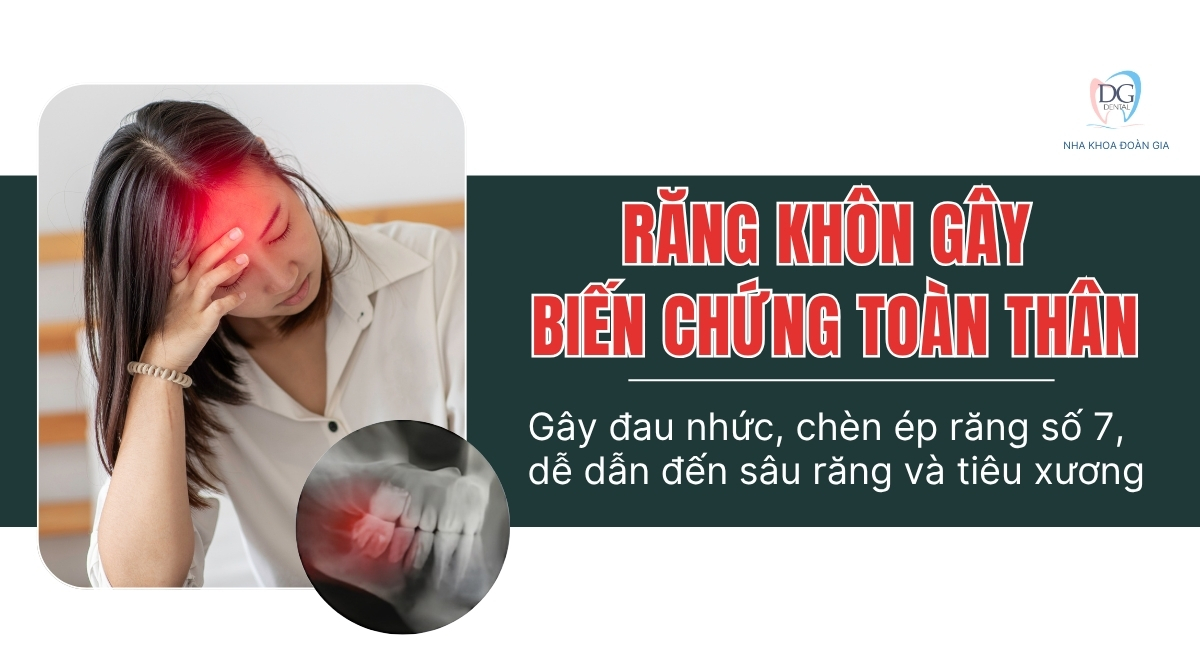 4 ĐỐI TƯỢNG NÊN NRK 4