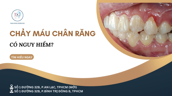 52. CHẢY MÁU CHÂN RĂNG KHI ĐÁNH RĂNG  CÓ NGUY HIỂM KHÔNG