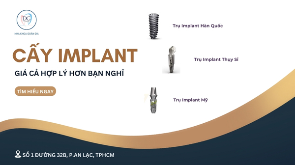 6. CẤY IMPLANT GIÁ CẢ HỢP LÝ HƠN BẠN NGHĨ