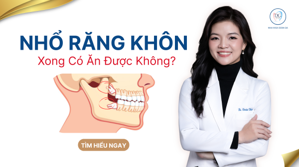 6. NHỔ RĂNG KHÔN XONG CÓ ĂN ĐƯỢC KHÔNG