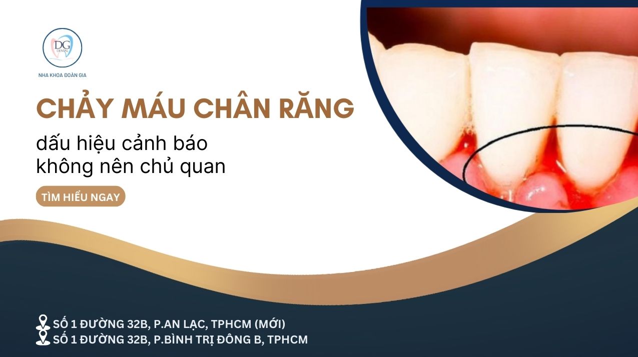 8. CHẢY MÁU CHÂN RĂNG DẤU HIỆU CẢNH BÁO BỆNH LÝ BẠN KHÔNG NÊN CHỦ QUAN