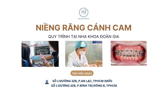 9. LỘ TRÌNH ĐIỀU TRỊ BẰNG NIỀNG MẮC CÀI CÁNH CAM TẠI NHA KHOA