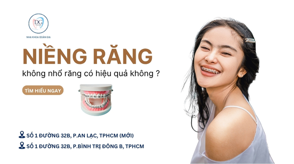 9. NIỀNG RĂNG KHÔNG NHỔ RĂNG CÓ HIỆU QUẢ KHÔNG