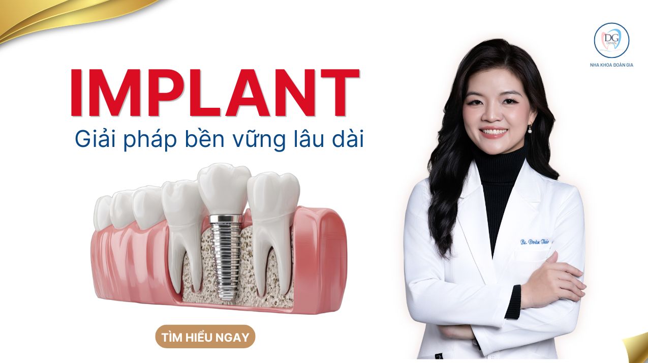 IMPLANT GIẢI PHÁP BỀN VỮNG