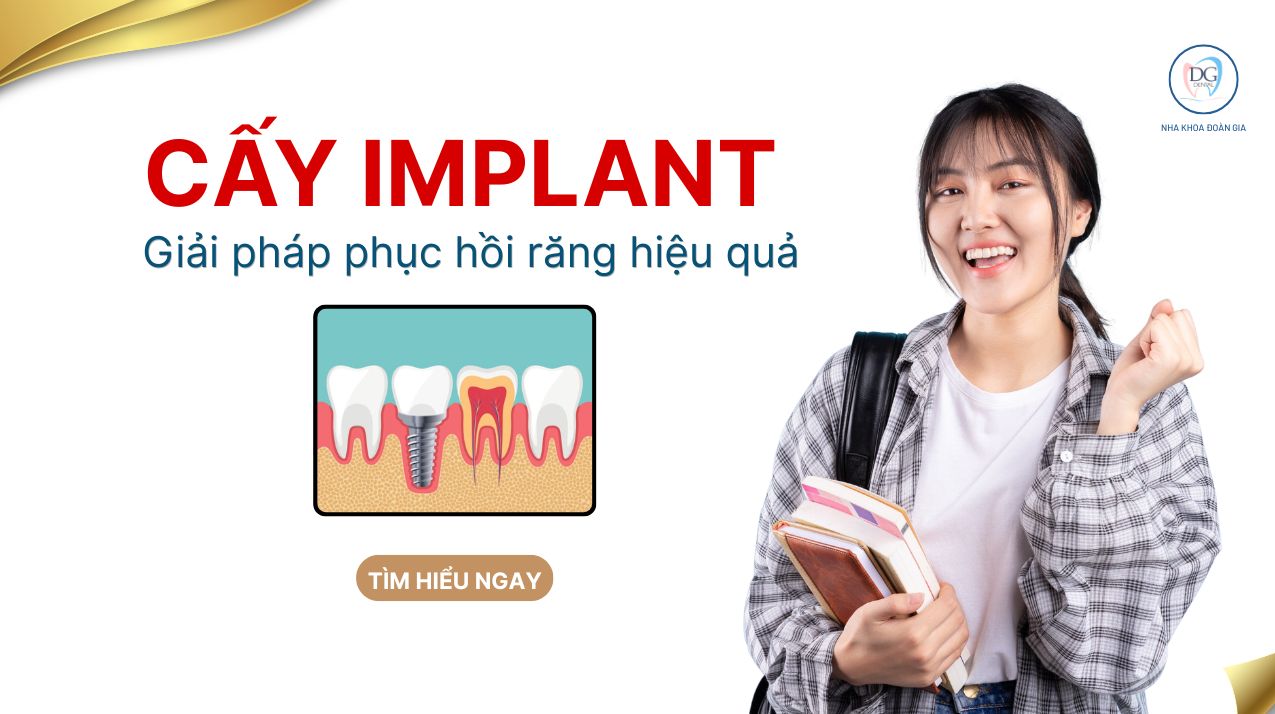 IMPLANT KHÔNG ĐAU - PHỤC HỒI RĂNG HIỆU QUẢ