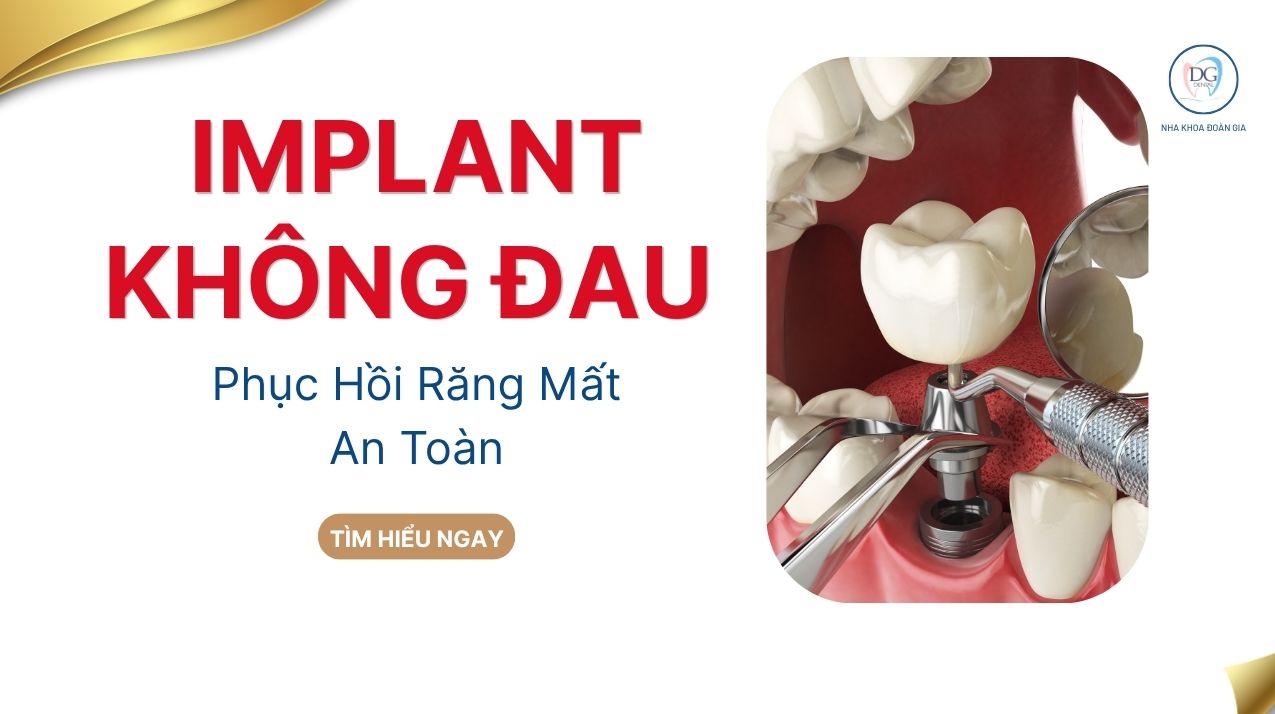 IMPLANT PHỤC HỒI RĂNG MẤT AN TOÀN