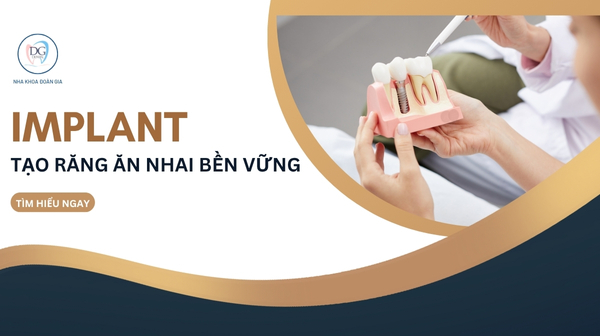 IMPLANT TẠO RĂNG ĂN NHAI BỀN VỮNG