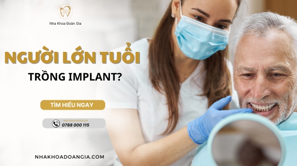 NGƯỜI LỚN TUỔI CÓ TRỒNG IMPLANT