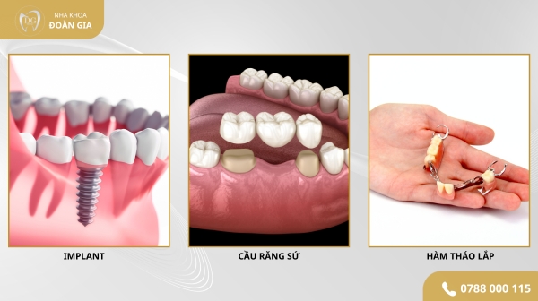 NGƯỜI LỚN TUỔI CÓ TRỒNG IMPLANT 2