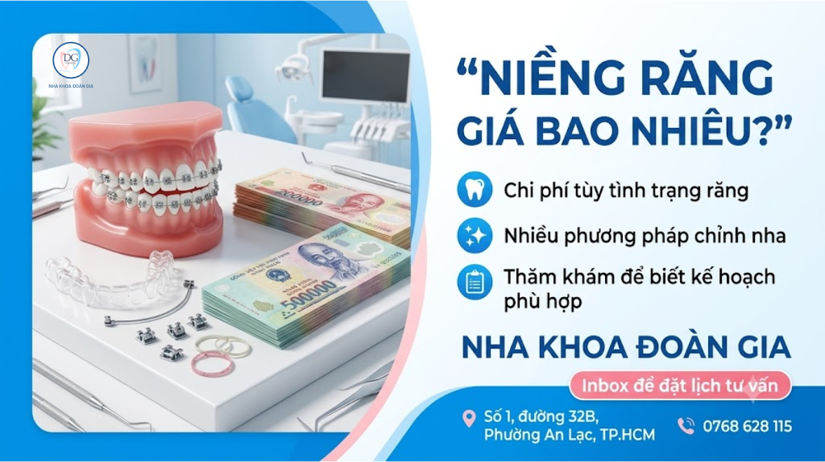 NIỀNG RĂNG BAO NHIÊU
