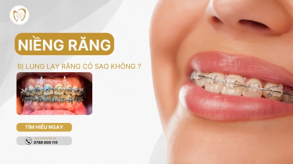 NIỀNG RĂNG BỊ LL CÓ SAO KO