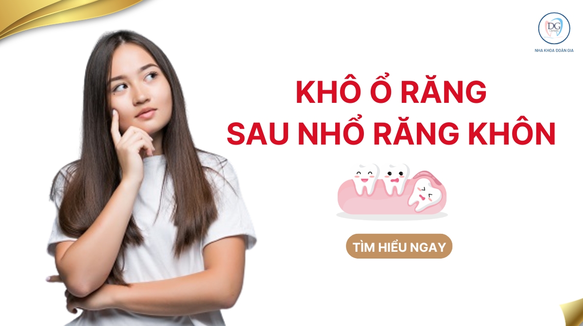 Nhổ răng khôn bị khô ổ răng