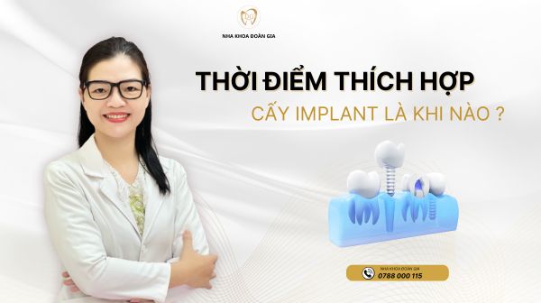 THỜI ĐIỂM THÍCH HỢP CẤY GHÉP IMPLANT