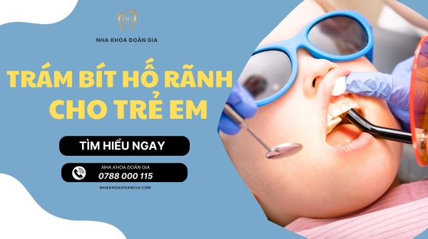 TRÁM BÍT HỐ RÃNH