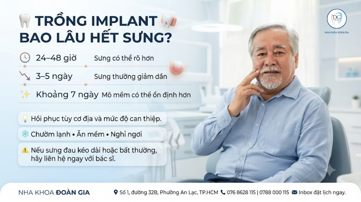TRỒNG IMPLANT BAO LÂU HẾT SƯNG 1