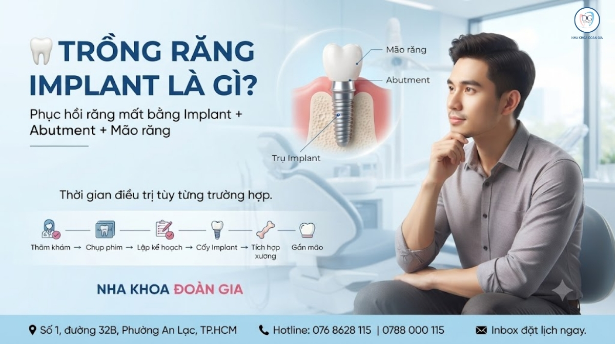 TRỒNG IMPLANT CÓ CẦN NGHỈ LÀM