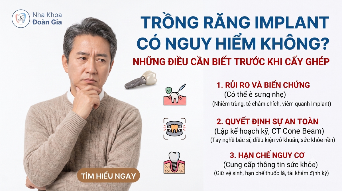 TRỒNG IMPLANT CÓ NGUY HIỂM KHÔNG