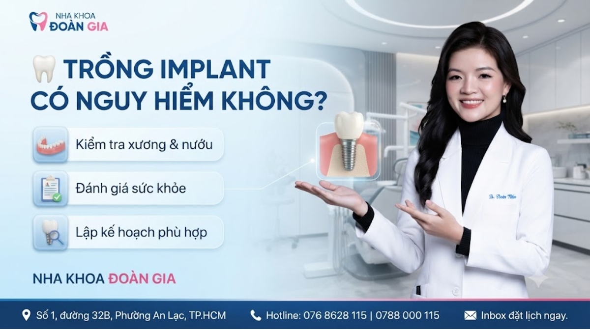 TRỒNG IMPLANT CÓ NGUY HIỂM KHÔNG 1