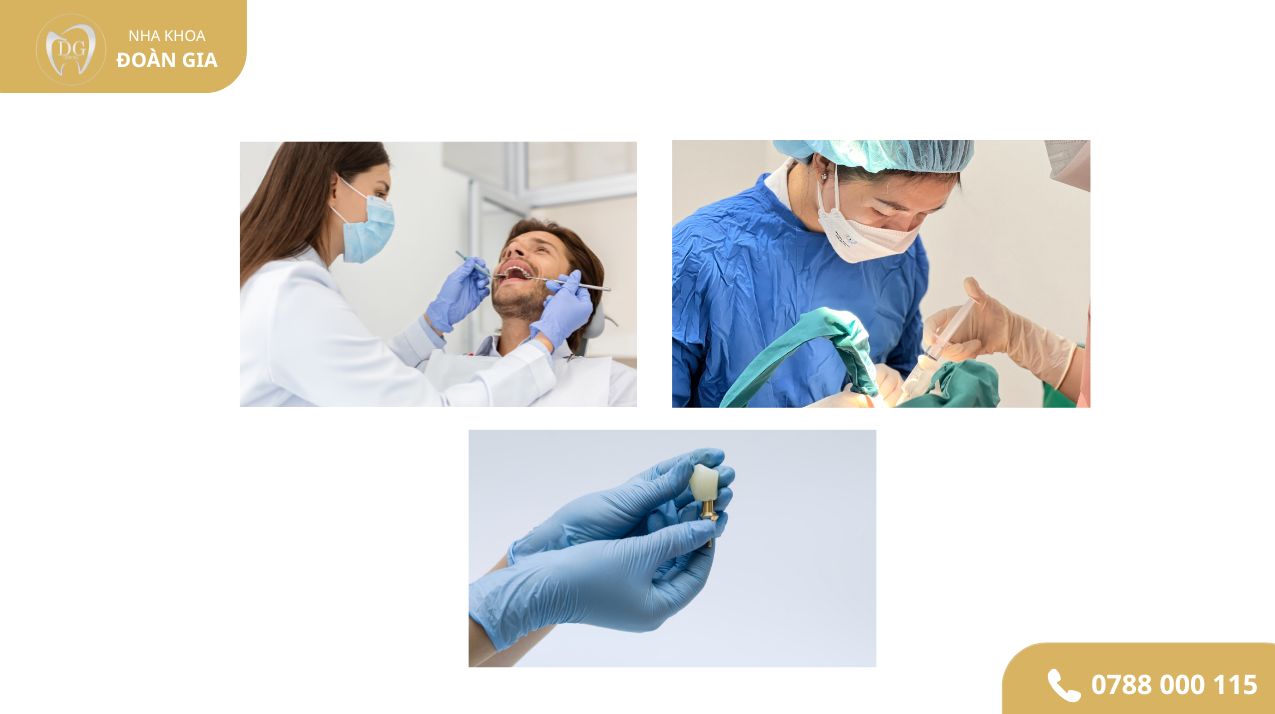 TRỒNG IMPLANT KHÔNG ĐAU 2