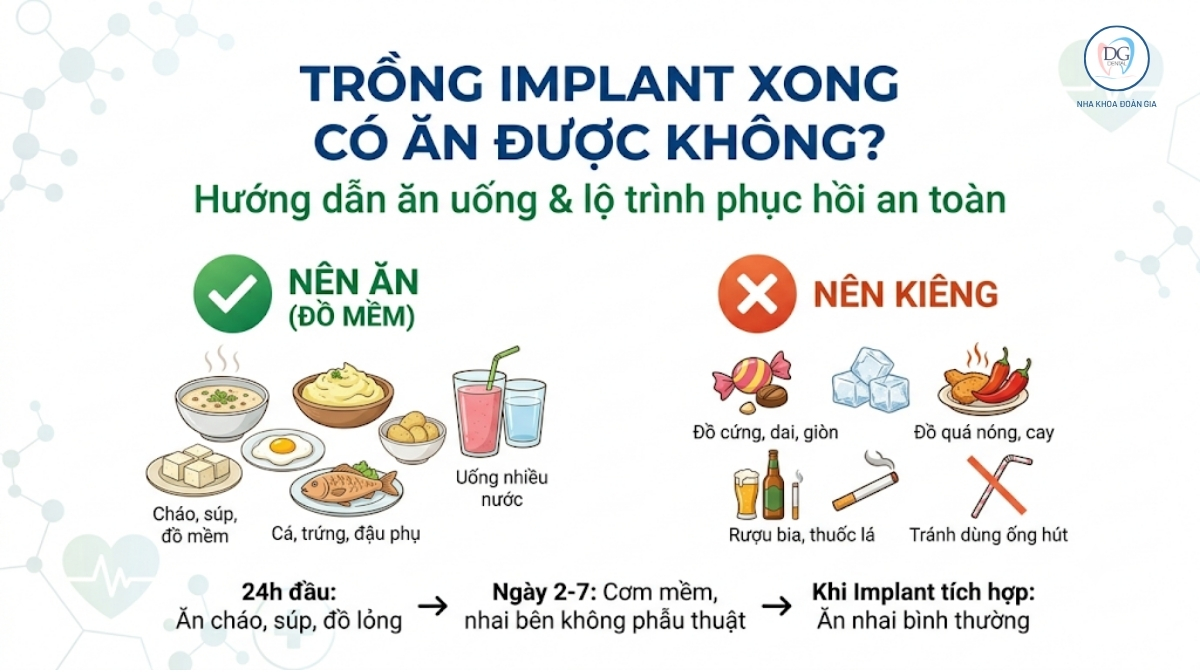 TRỒNG IMPLANT ĂN UỐNG GÌ ĐƯỢC KHÔNG