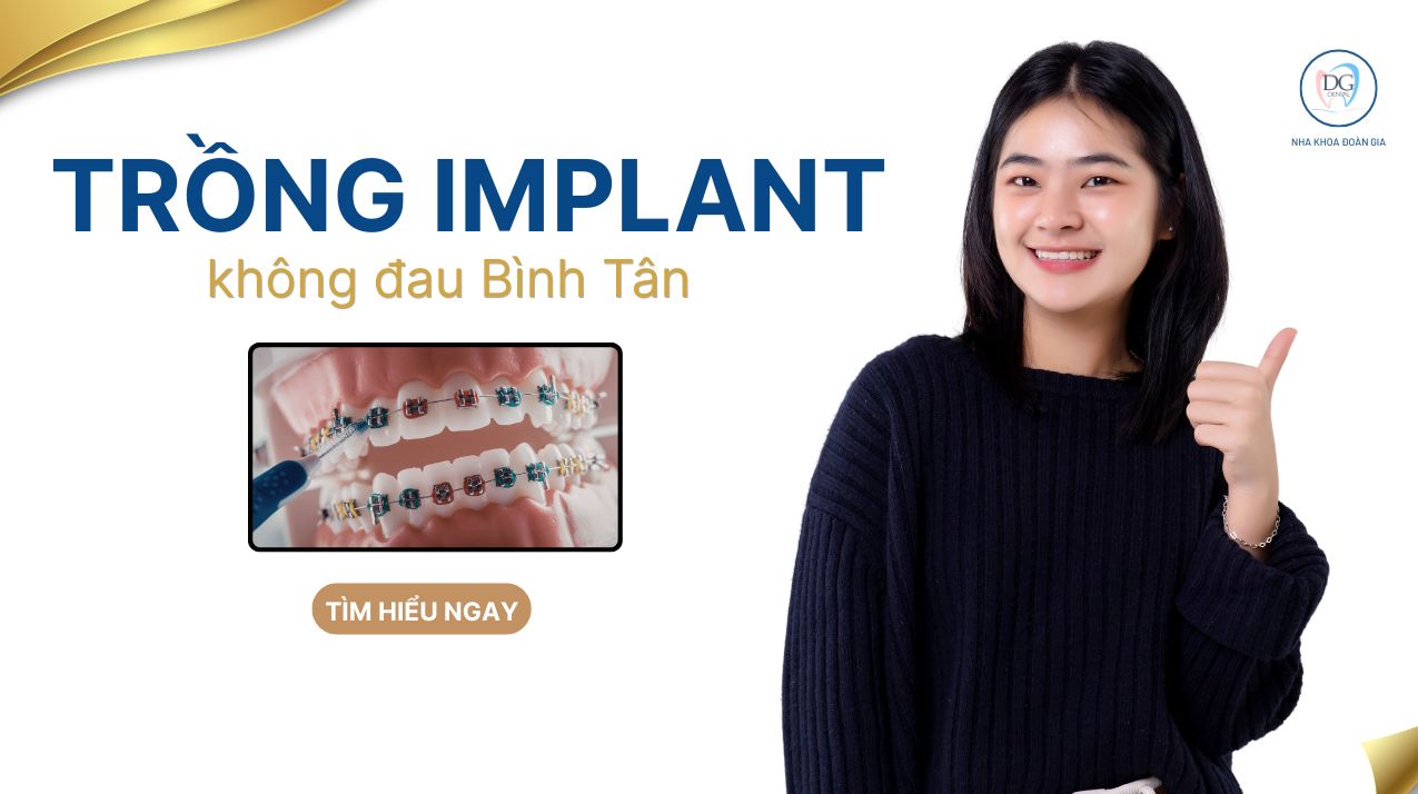 TRỒNG RĂNG IMPLANT KHÔNG ĐAU