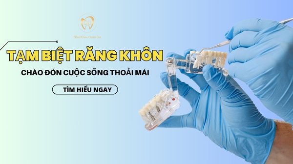 TẠM BIỆT RĂNG KHÔN - CHÀO ĐÓN CUỘC SỐNG THOẢI MÁI