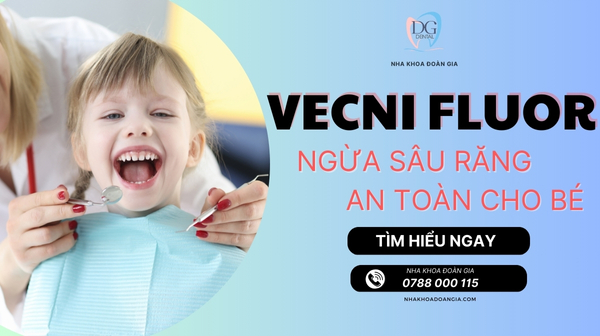 VECNI FLUOR NGỪA SÂU RĂNG