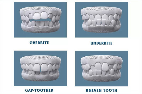 Những thuật ngữ tiếng Anh quan trọng trong nha khoa