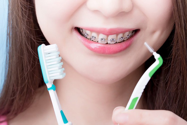 Cách chăm sóc răng miệng khi niềng răng