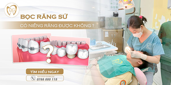 Sau khi bọc răng sứ có niềng được không?