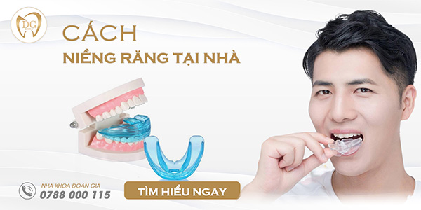 Những cách niềng răng tại nhà có thực sự hiệu quả?