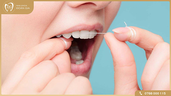 Một số điều quan trọng bạn cần biết sau khi lấy cao răng