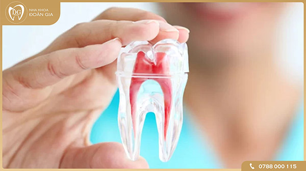 Mục đích của việc lấy tủy răng là gì?