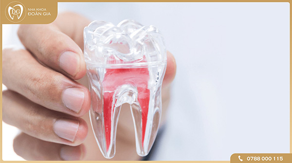 Chữa tủy răng số 6 và chữa tủy răng số 7 là gì?