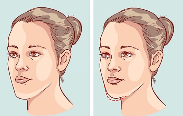 Ảnh hưởng của hàm răng đến khuôn mặt như thế nào?