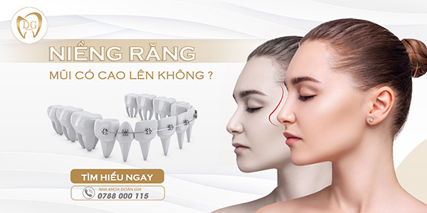 Niềng răng mũi có cao lên không?