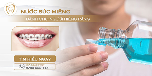 Tất tần tật về nước súc miệng cho người niềng răng