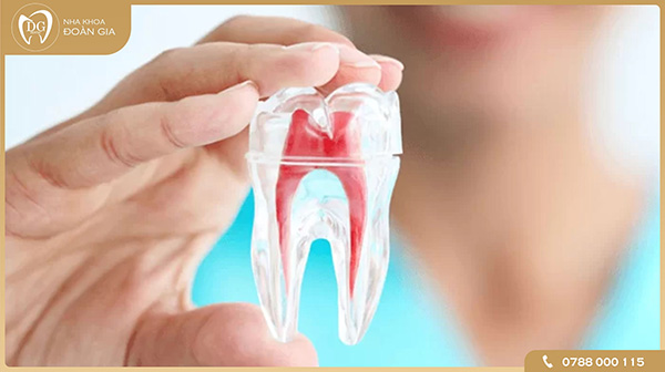 Răng chữa tủy tồn tại được bao lâu?