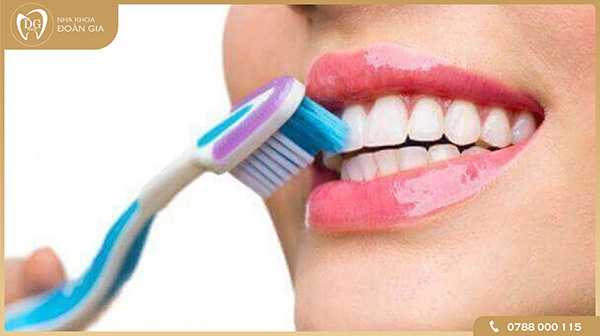 Cách chăm sóc sau khi tẩy trắng răng