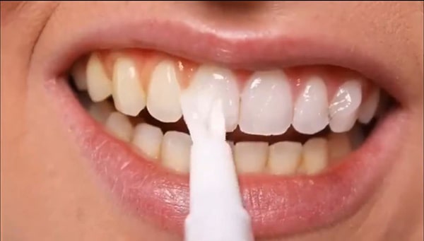 Những lưu ý khi sử dụng tẩy trắng răng Lanbena
