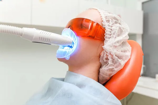 Công nghệ tẩy trắng răng laser whitening