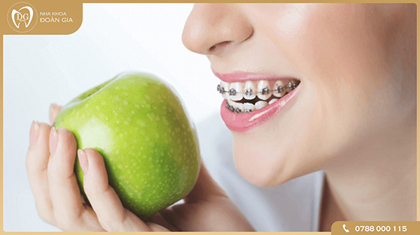 Thói quen ăn uống ảnh hưởng đến quá trình niềng răng như thế nào?