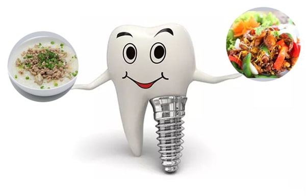 Trồng răng Implant cần kiêng ăn gì?