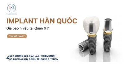 TRỒNG IMPLANT HÀN QUỐC TẠI QUẬN 6 – GIÁ BAO NHIÊU?