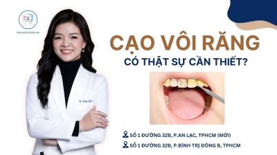 CẠO V&Ocirc;I RĂNG C&Oacute; THẬT SỰ CẦN THIẾT HAY CHỈ L&Agrave; DỊCH VỤ L&Agrave;M ĐẸP?